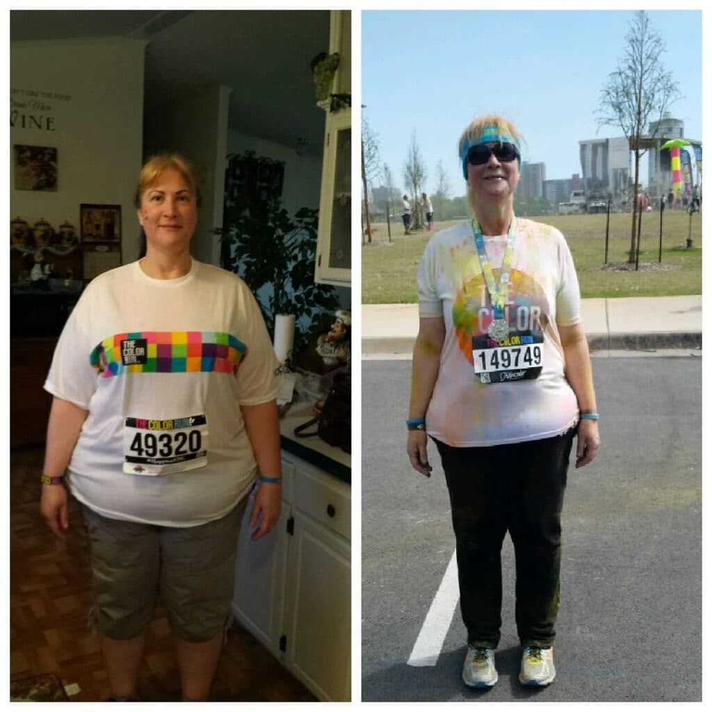 Nicolle's before and after weight loss photos