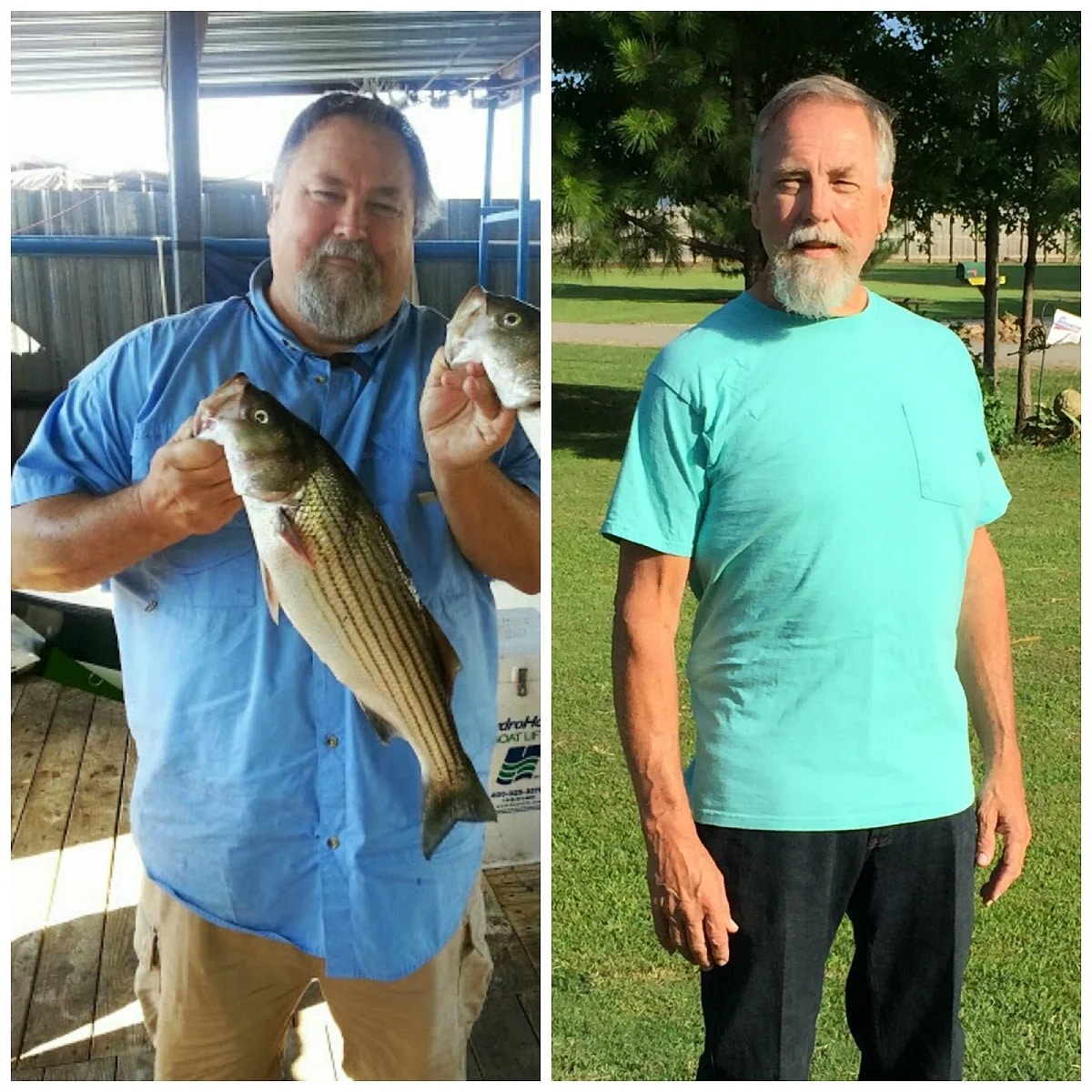 Weight Loss Surgery Saves a Man’s Life